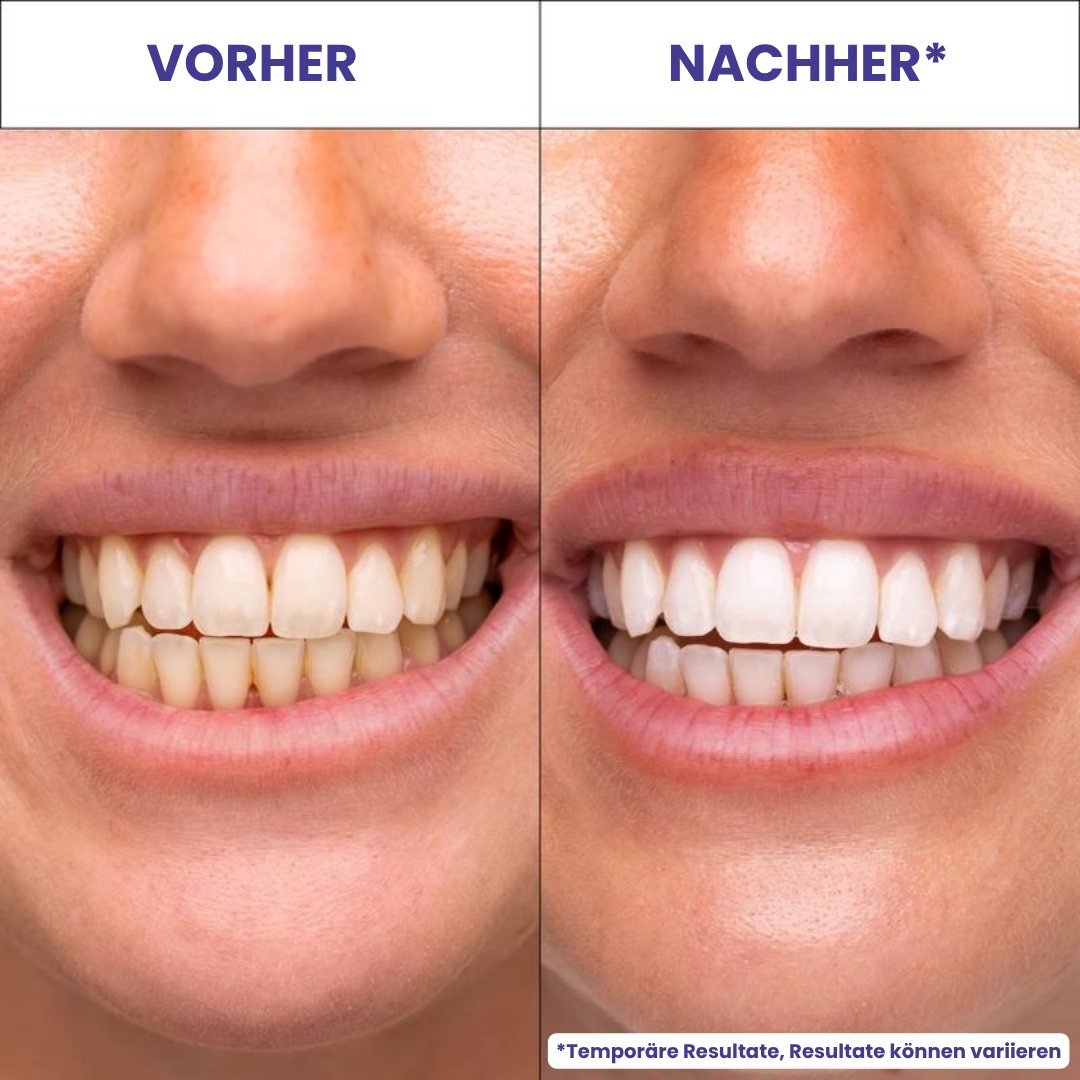 Nevela SmileBright™