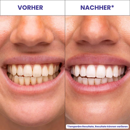 Nevela SmileBright™