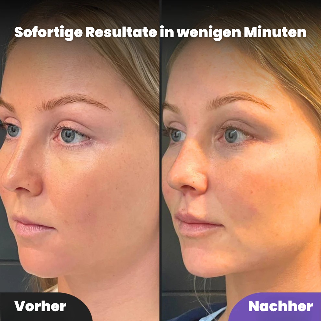 Nevela® Define Beauty Sculptor